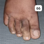 edema-support-foundation-gallery24