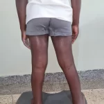 edema-support-foundation-gallery3