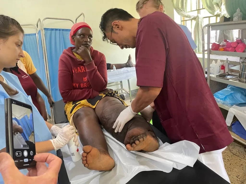 edema-support-foundation-patient-321